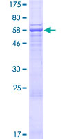 AMZ2 Protein - 12.5% SDS-PAGE of human AMZ2 stained with Coomassie Blue