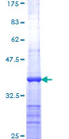 ANAPC1 / APC1 Protein - 12.5% SDS-PAGE Stained with Coomassie Blue.
