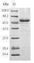ANAPC10 / APC10 Protein - (Tris-Glycine gel) Discontinuous SDS-PAGE (reduced) with 5% enrichment gel and 15% separation gel.