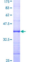ANAPC10 / APC10 Protein - 12.5% SDS-PAGE Stained with Coomassie Blue.