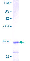 ANAPC11 / APC11 Protein - 12.5% SDS-PAGE of human ANAPC11 stained with Coomassie Blue