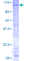 ANAPC2 / APC2 Protein - 12.5% SDS-PAGE of human ANAPC2 stained with Coomassie Blue
