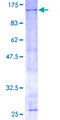 ANAPC2 / APC2 Protein - 12.5% SDS-PAGE of human ANAPC2 stained with Coomassie Blue
