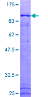 ANAPC5 / APC5 Protein - 12.5% SDS-PAGE of human ANAPC5 stained with Coomassie Blue