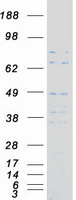ANGEL1 Protein - Purified recombinant protein ANGEL1 was analyzed by SDS-PAGE gel and Coomassie Blue Staining