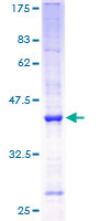 Angiogenin / ANG Protein - 12.5% SDS-PAGE of human ANG stained with Coomassie Blue