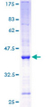 Angiogenin / ANG Protein - 12.5% SDS-PAGE of human ANG stained with Coomassie Blue