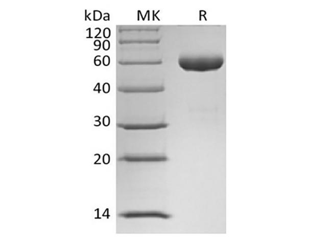 ANGPT1 / Angiopoietin-1 Protein - Recombinant Human Angiopoietin-1/ANG1 (N-Fc)