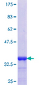ANGPT1 / Angiopoietin-1 Protein - 12.5% SDS-PAGE Stained with Coomassie Blue.