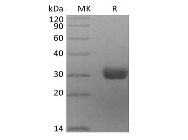 ANGPT2 / Angiopoietin-2 Protein - Recombinant Human Angiopoietin-2/ANG2 (C-6His)