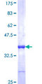 ANGPT4 / Angiopoietin-4 Protein - 12.5% SDS-PAGE Stained with Coomassie Blue.