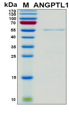 ANGPTL1 Protein - SDS-PAGE under reducing conditions and visualized by Coomassie blue staining