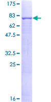 ANGPTL1 Protein - 12.5% SDS-PAGE of human ANGPTL1 stained with Coomassie Blue