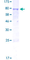 ANGPTL2 / ARP2 Protein - 12.5% SDS-PAGE of human ANGPTL2 stained with Coomassie Blue