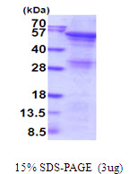 ANGPTL2 / ARP2 Protein
