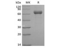 ANGPTL3 Protein - Recombinant Human Angiopoietin-related Protein 3/ANGPTL3 (C-Fc)