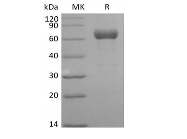 ANGPTL3 Protein - Recombinant Human Angiopoietin-related Protein 3/ANGPTL3 (C-Fc)