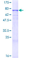 ANGPTL3 Protein - 12.5% SDS-PAGE of human ANGPTL3 stained with Coomassie Blue
