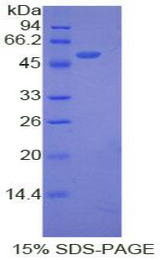 ANGPTL3 Protein