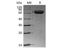 ANGPTL4 Protein - Recombinant Human Sialic acid-binding Ig-like lectin 15/Siglec-15/CD33L3 (C-Fc)