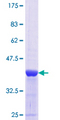 ANGPTL4 Protein - 12.5% SDS-PAGE Stained with Coomassie Blue.