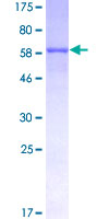 ANGPTL5 Protein - 12.5% SDS-PAGE of human ANGPTL5 stained with Coomassie Blue