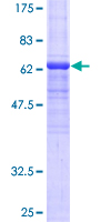 ANGPTL7 / CDT6 Protein - 12.5% SDS-PAGE of human ANGPTL7 stained with Coomassie Blue