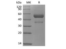 ANGPTL7 / CDT6 Protein - Recombinant Human Angiopoietin-related Protein 7/ANGPTL7 (C-10His-Avi) Biotinylated