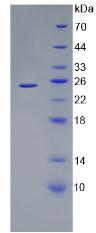 ANGPTL8 / Betatrophin Protein - Recombinant Angiopoietin Like Protein 8 By SDS-PAGE