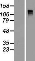 Anillin Protein - Western validation with an anti-DDK antibody * L: Control HEK293 lysate R: Over-expression lysate