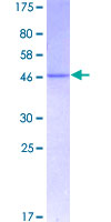ANK1 / Ankyrin Protein - 12.5% SDS-PAGE of human ANK1 stained with Coomassie Blue