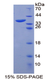 ANK1 / Ankyrin Protein - Recombinant  Ankyrin 1, Erythrocytic By SDS-PAGE