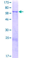ANKDD1A Protein - 12.5% SDS-PAGE of human ANKDD1A stained with Coomassie Blue