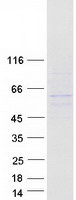 ANKDD1A Protein - Purified recombinant protein ANKDD1A was analyzed by SDS-PAGE gel and Coomassie Blue Staining