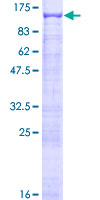 ANKEF1 / ANKRD5 Protein - 12.5% SDS-PAGE of human ANKRD5 stained with Coomassie Blue