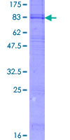 ANKH Protein - 12.5% SDS-PAGE of human ANKH stained with Coomassie Blue