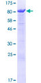 ANKHD1 Protein - 12.5% SDS-PAGE of human ANKHD1 stained with Coomassie Blue