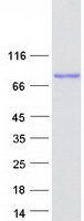 ANKHD1 Protein - Purified recombinant protein ANKHD1 was analyzed by SDS-PAGE gel and Coomassie Blue Staining