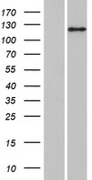 ANKIB1 Protein - Western validation with an anti-DDK antibody * L: Control HEK293 lysate R: Over-expression lysate