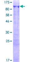 ANKMY1 Protein - 12.5% SDS-PAGE of human ANKMY1 stained with Coomassie Blue