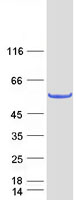 ANKMY2 Protein - Purified recombinant protein ANKMY2 was analyzed by SDS-PAGE gel and Coomassie Blue Staining