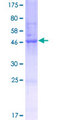 ANKRD10 Protein - 12.5% SDS-PAGE of human ANKRD10 stained with Coomassie Blue