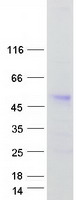 ANKRD10 Protein - Purified recombinant protein ANKRD10 was analyzed by SDS-PAGE gel and Coomassie Blue Staining