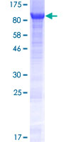 ANKRD13A Protein - 12.5% SDS-PAGE of human ANKRD13A stained with Coomassie Blue