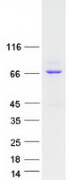 ANKRD13B Protein - Purified recombinant protein ANKRD13B was analyzed by SDS-PAGE gel and Coomassie Blue Staining