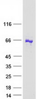ANKRD13C Protein - Purified recombinant protein ANKRD13C was analyzed by SDS-PAGE gel and Coomassie Blue Staining