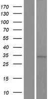 ANKRD16 Protein - Western validation with an anti-DDK antibody * L: Control HEK293 lysate R: Over-expression lysate
