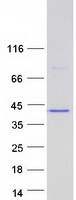 ANKRD16 Protein - Purified recombinant protein ANKRD16 was analyzed by SDS-PAGE gel and Coomassie Blue Staining