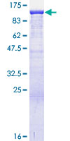 ANKRD17 Protein - 12.5% SDS-PAGE of human ANKRD17 stained with Coomassie Blue