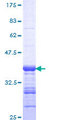 ANKRD17 Protein - 12.5% SDS-PAGE Stained with Coomassie Blue.